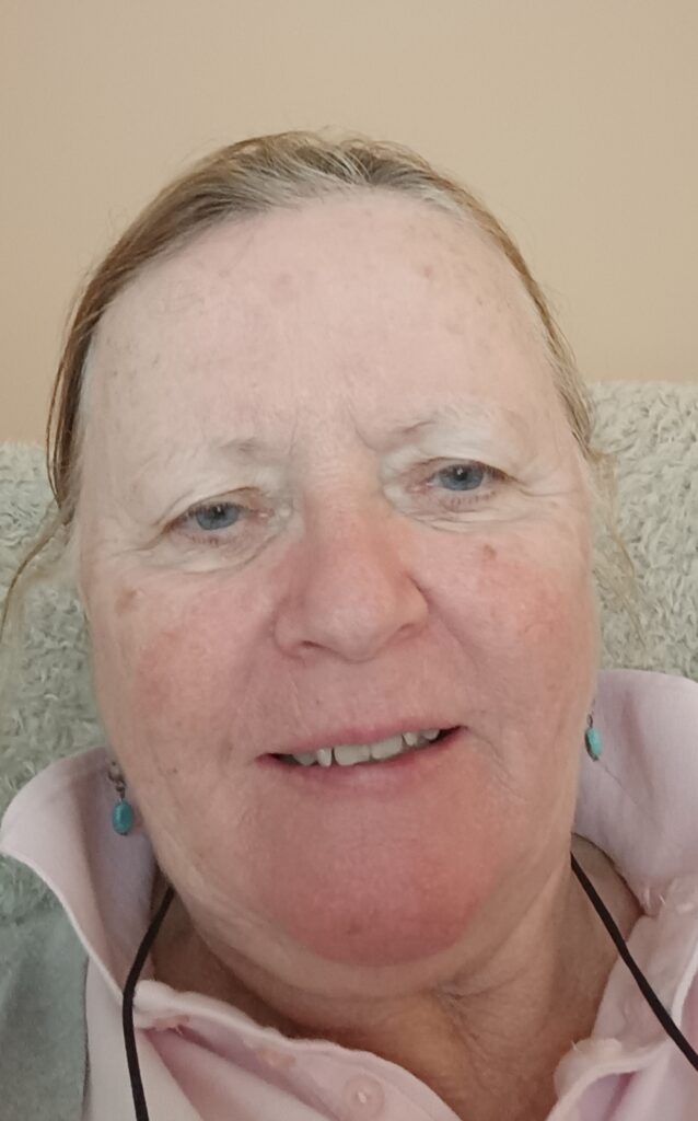 Empowering Mobility: Michelle’s Story of Overcoming Arthritis with Long Term Conditions Swim Class